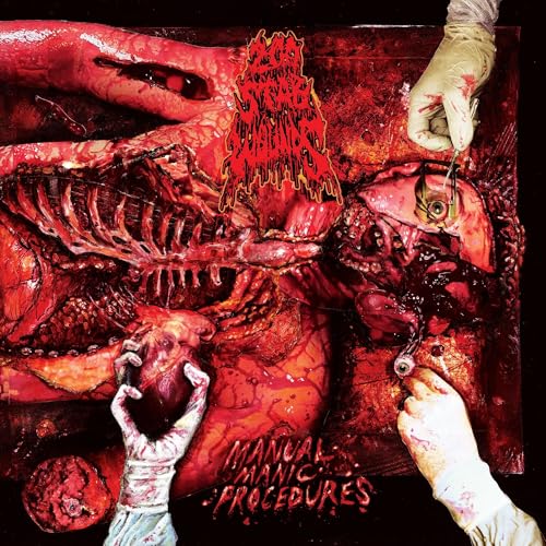 200 STAB WOUNDS - MANUAL MANIC PROCEDURES (CD)